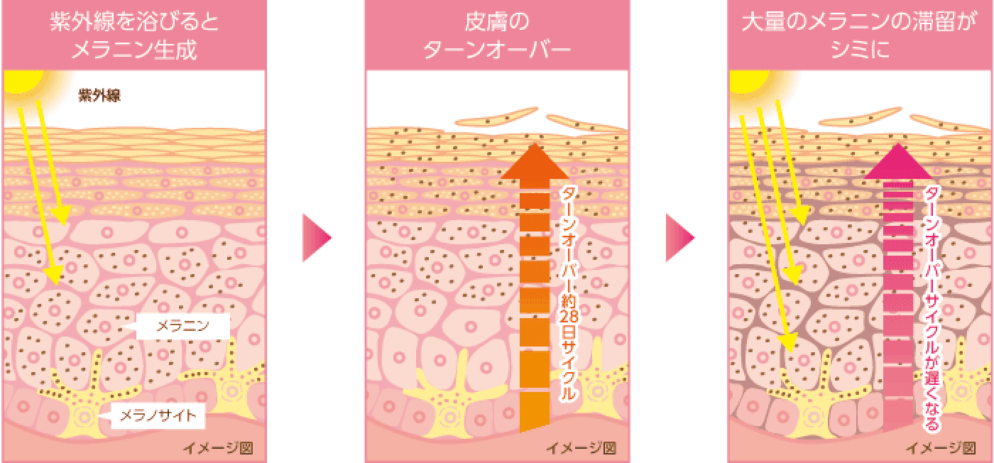 シミができるメカニズム